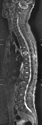 医療法人聖比留会 セントヒル病院 セムイPET・画像診断センター脊椎の映像