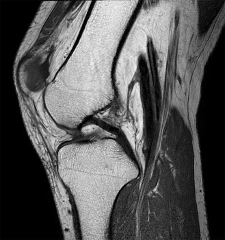 医療法人聖比留会 セントヒル病院 セムイPET・画像診断センター膝関節の映像