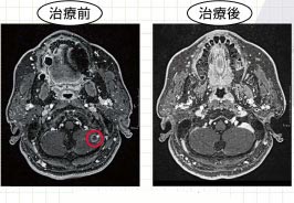 勃起不全心不全薬