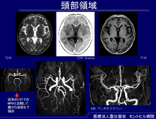 専用 脳ＭＲＩ ３ - 健康/医学