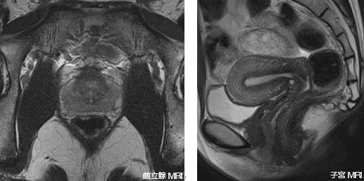 医療法人聖比留会 セントヒル病院 セムイPET・画像診断センター