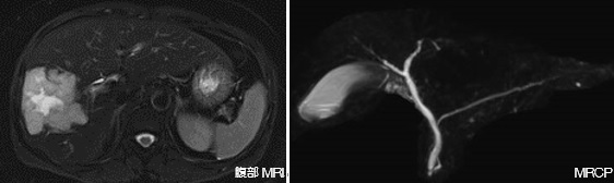 医療法人聖比留会 セントヒル病院 セムイPET・画像診断センター