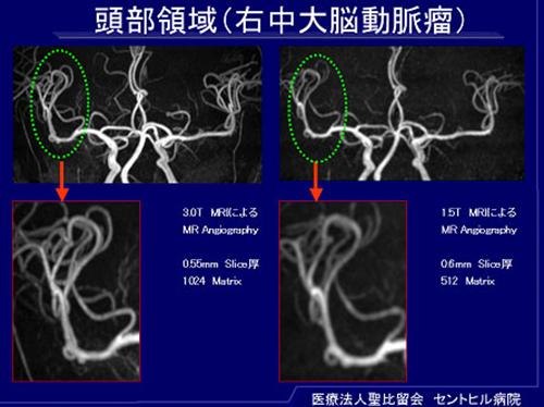 医療法人聖比留会 セントヒル病院 セムイPET・画像診断センター頭部領域の映像2