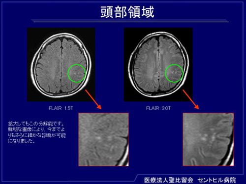医療法人聖比留会 セントヒル病院 セムイPET・画像診断センター頭部領域の映像3