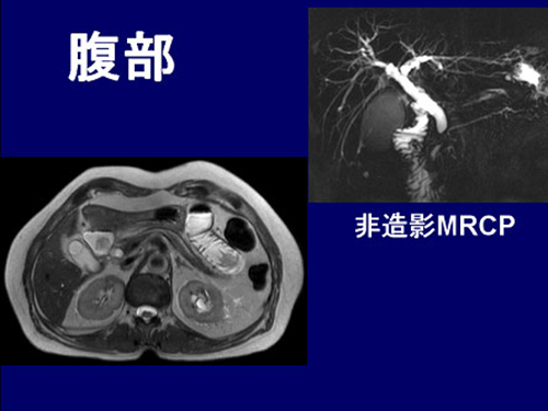 医療法人聖比留会 セントヒル病院 セムイPET・画像診断センター腹部の映像