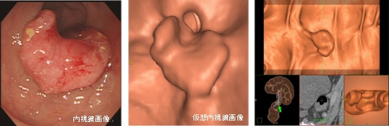 医療法人聖比留会 セントヒル病院 セムイPET・画像診断センター